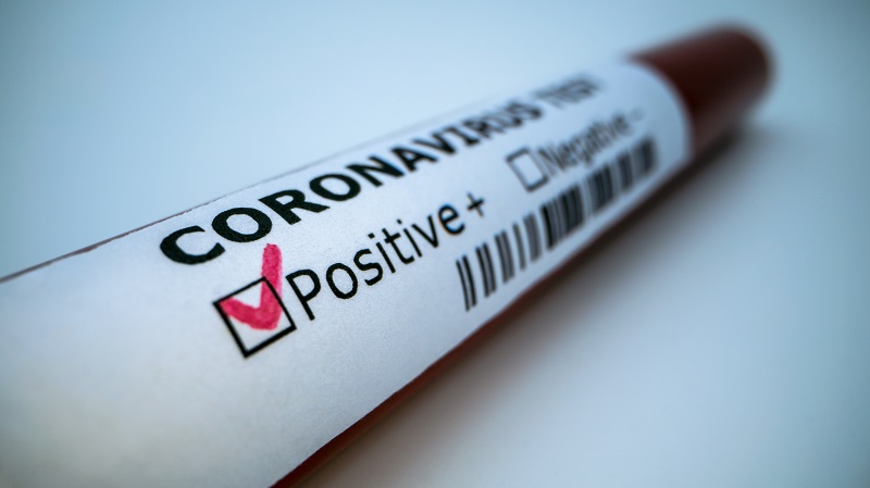 covid-19 positive test tube