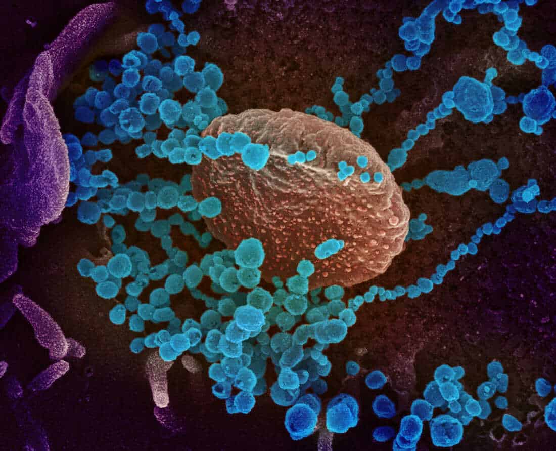 How many waves of coronavirus pandemic will there be? What is long COVID in Omicron variant? How many waves of coronavirus pandemic will there be? What is long COVID in Omicron variant?