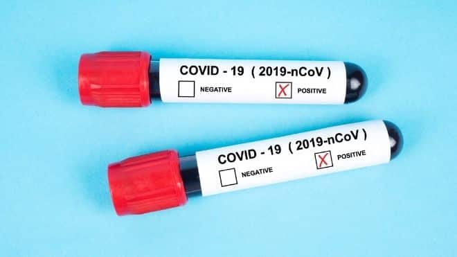 covid-19 tests that show positive, which the cdc has changed guidance and guidelines on.