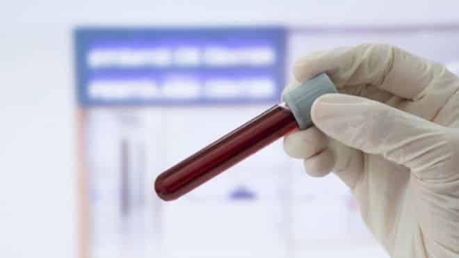 Williamson nurse shares BRCA2 screening experience after family cancer losses