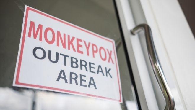 Monkeypox outbreak sign for those infected with symptoms.