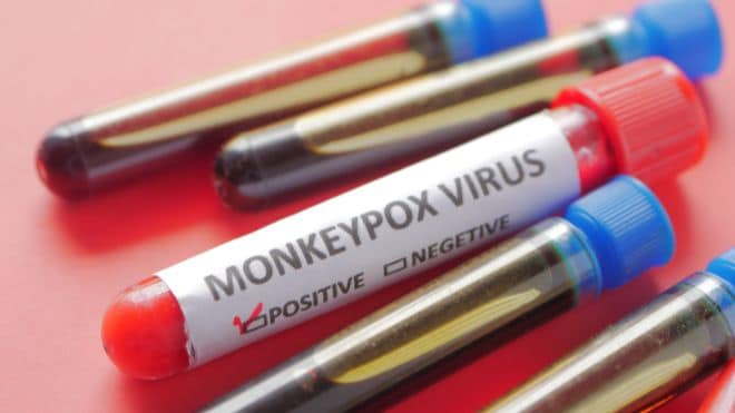 Monkeypox test vials that people are hoping for a vaccine for soon.