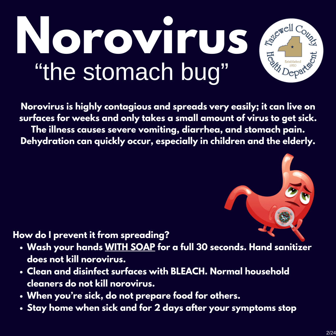 What is norovirus? Stomach virus spreads across northeast | Fingerlakes1.com