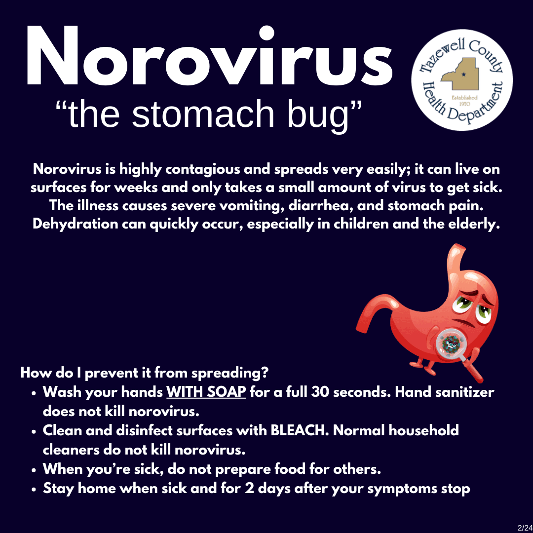 Norovirus highly contagious stomach virus remains a persistent public