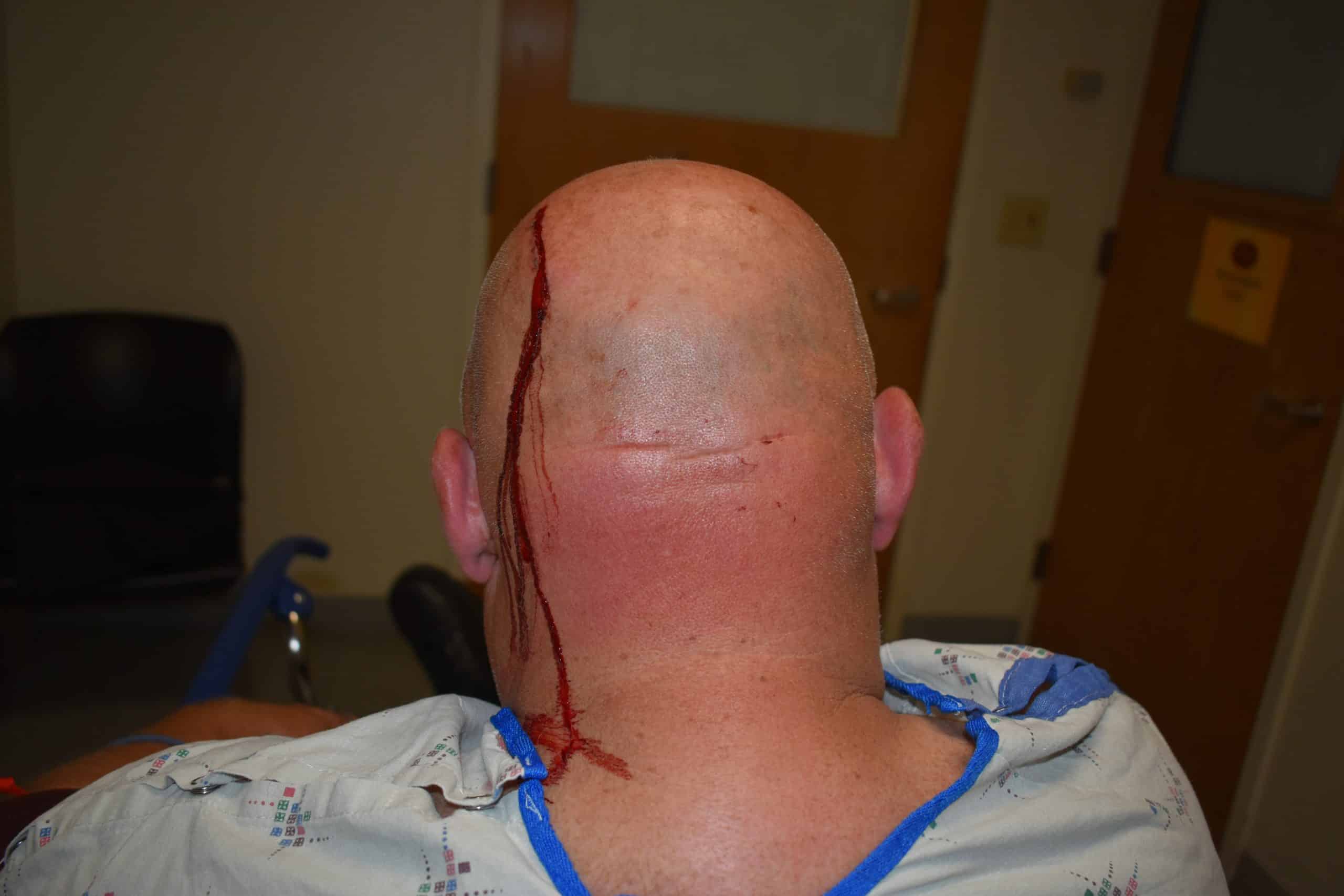 Inmate indicted after jail deputy attacked with makeshift weapons (video)