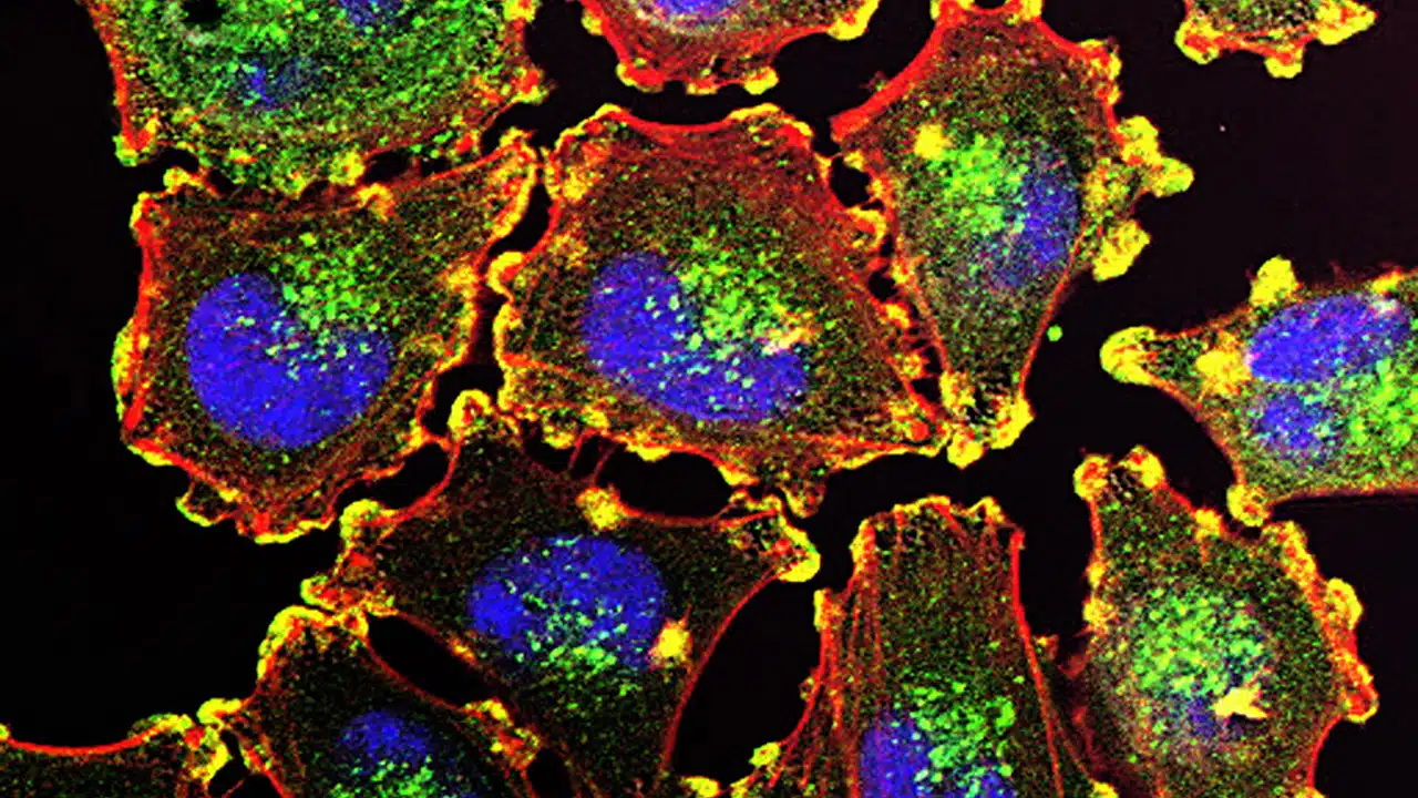 Cornell study points to timed immunotherapy approach for residual melanoma cells Cornell study points to timed immunotherapy approach for residual melanoma cells